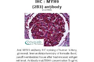 Image no. 1 for anti-Myosin 9 (MYH9) antibody (ABIN1723793) (Myosin 9 Antikörper)
