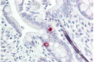Image no. 1 for anti-Neurotrimin (NTM) (AA 91-140) antibody (ABIN6749729) (Neurotrimin Antikörper  (AA 91-140))