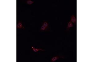 ABIN6276807 staining HepG2? (KNG1 Antikörper  (N-Term))