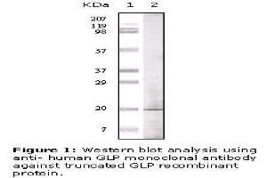 Image no. 1 for anti-Golgin A6 Family, Member A (GOLGA6A) antibody (ABIN207616) (GOLGA6A Antikörper)
