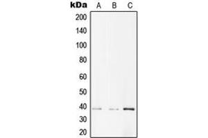 Western blot analysis of AMPK beta 1 (pS182) expression in A431 (A), NIH3T3 (B), PC12 (C) whole cell lysates. (PRKAB1 Antikörper  (pSer182))