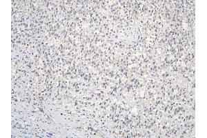 IHC analysis of CCDC36 using anti-CCDC36 antibody (ABIN6719645). (CCDC36 Antikörper  (AA 172-472))