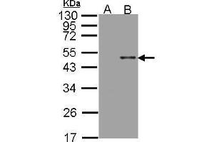 WB Image Western Blot analysis of ARSB expression in transfected 293T cell line by ARSB polyclonal antibody. (Arylsulfatase B Antikörper)