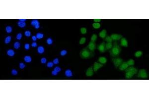 IF analysis of B MyB/MYBL2 using anti-B MyB/MYBL2 antibody (ABIN7601277).
