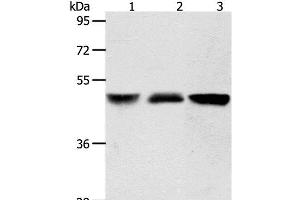 Western Blot analysis of Human brain malignant glioma and Human fetal kidney tissue, A172 cell using ACOT9 Polyclonal Antibody at dilution of 1:600 (ACOT9 Antikörper)