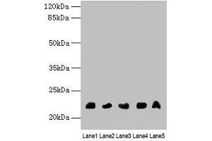 Western blot All lanes: NRSN1 antibody at 3 μg/mL Lane 1: Mouse stomach tissue Lane 2: Mouse kidney tissue Lane 3: Mouse thymus tissue Lane 4: Hela whole cell lysate Lane 5: 293T whole cell lysate Secondary Goat polyclonal to rabbit IgG at 1/10000 dilution Predicted band size: 22 kDa Observed band size: 22 kDa (Neurensin 1 Antikörper  (AA 1-65))