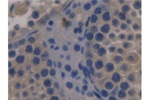 Detection of FBLN1 in Mouse Testis Tissue using Monoclonal Antibody to Fibulin 1 (FBLN1) (Fibulin 1 Antikörper  (AA 399-578))