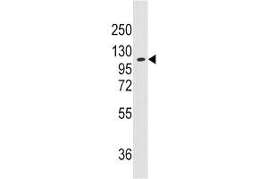 Western Blotting (WB) image for anti-Alanyl-tRNA Synthetase 2, Mitochondrial (AARS2) antibody (ABIN3003290) (AARS2 Antikörper)