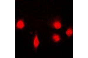 Immunofluorescent analysis of SH2B1 staining in U2OS cells.
