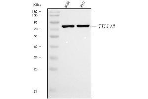 Western blot analysis of TTLL12 using anti-TTLL12 antibody (ABIN7602497). (TTLL12 Antikörper  (AA 8-634))