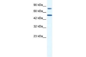 WB Suggested Anti-ZNF223 Antibody Titration:  0. (ZNF223 Antikörper  (N-Term))