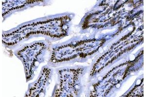 IHC analysis of CTBP2 using anti-CTBP2 antibody (ABIN7601326). (CTBP2 Antikörper  (AA 321-445))