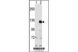 Western blot analysis of EphA3 using rabbit polyclonal EphA3 Antibody.