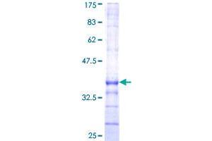 Image no. 1 for EGF like repeats and discoidin domains 3 (DEL1) (AA 101-199) protein (GST tag) (ABIN1352321) (EDIL3 Protein (AA 101-199) (GST tag))