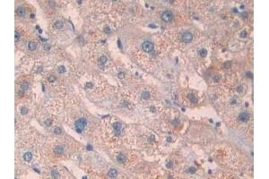 Immunohistochemistry (IHC) image for anti-Interleukin 1 Receptor, Type I (IL1R1) (AA 226-318) antibody (ABIN7437953)