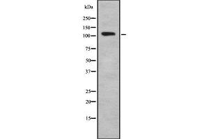 Western blot analysis of TSH1 using A549 whole cell lysates (TSHZ1 Antikörper  (Internal Region))