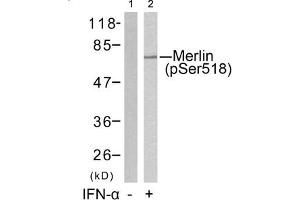 Western blot analysis of extracts from HUVEC cells untreated(lane 1) or treated with IFN-a(lane 2) using Merlin(Phospho-Ser518) Antibody. (Merlin Antikörper  (pSer518))