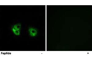 Immunofluorescence analysis of A-549 cells, using MARCH2 polyclonal antibody . (MARCH2 Antikörper)