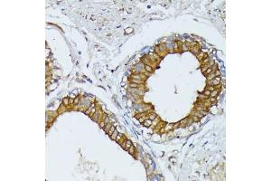 Immunohistochemistry (IHC) image for anti-Wingless-Type MMTV Integration Site Family, Member 1 (WNT1) (AA 231-370) antibody (ABIN1683291)
