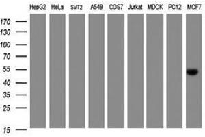 Image no. 1 for anti-Selenium Binding Protein 1 (SELENBP1) antibody (ABIN1500862) (SELENBP1 Antikörper)