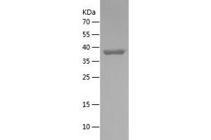 Western Blotting (WB) image for Serpin Family H Member 1 (SERPINH1) (AA 98-257) protein (His-IF2DI Tag) (ABIN7125055)
