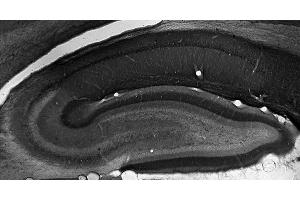 Adult rat hippocampus immunohistochemistry.
