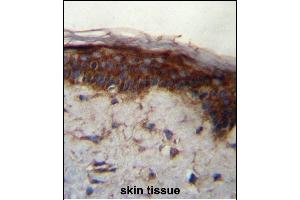 LRRC37B Antibody (C-term) (ABIN657113 and ABIN2846260) immunohistochemistry analysis in formalin fixed and paraffin embedded human skin tissue followed by peroxidase conjugation of the secondary antibody and DAB staining. (LRRC37B Antikörper  (C-Term))