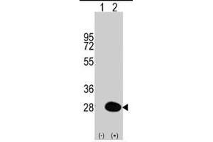 Western blot analysis of HSPB1 (arrow) using HSPB1 polyclonal antibody . (HSP27 Antikörper  (Ser83))