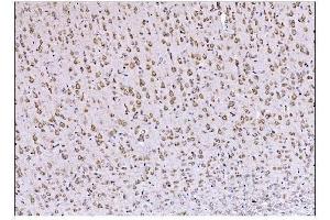 IHC analysis of DLGAP1 using anti-DLGAP1 antibody (ABIN7600257).