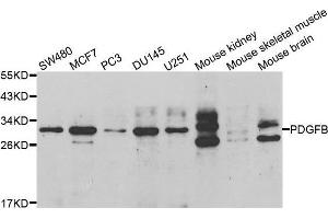 Western blot analysis of extracts of various cell lines, using PDGFB antibody. (PDGFB Antikörper  (AA 20-241))