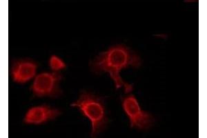 ABIN6276005 staining RAW264. (ADGRF4 (C-Term) Antikörper)