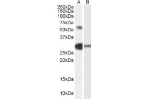 Western Blotting (WB) image for anti-Transcription Factor-Like 5 (Basic Helix-Loop-Helix) (TCFL5) (AA 400-413) antibody (ABIN296838) (TCFL5 Antikörper  (AA 400-413))
