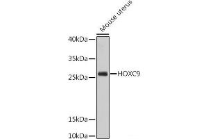 Western blot analysis of extracts of Mouse uterus using HOXC9 Polyclonal Antibody at dilution of 1:1000. (HOXC9 Antikörper)