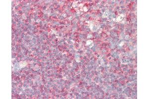 Anti-PIP5K1A antibody IHC staining of human tonsil.