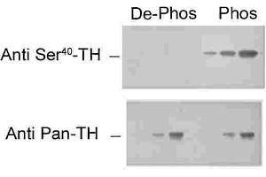 Immunohistochemical staining of retina with the pan-tyrosine hydroxylase (pan-TH) and phospho-specific tyrosine hydroxylase (phospho-TH) antibodies. (Tyrosine Hydroxylase Antikörper  (pSer40))