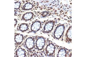 Immunohistochemistry of paraffin-embedded human colon using Histone H4 Rabbit mAb (ABIN7267706) at dilution of 1:100 (40x lens). (HIST4H4 Antikörper)