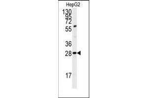 Image no. 1 for anti-Pancreatic and Duodenal Homeobox 1 (PDX1) (C-Term) antibody (ABIN360027) (PDX1 Antikörper  (C-Term))