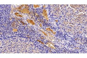 Immunohistochemistry (IHC) image for anti-Leptin (LEP) (AA 22-167) antibody (ABIN7429181)