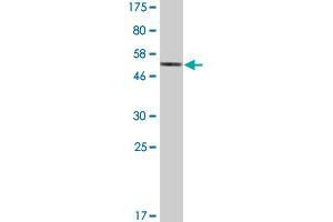 Western Blot detection against Immunogen (48. (ATF2 Antikörper  (AA 1-209))