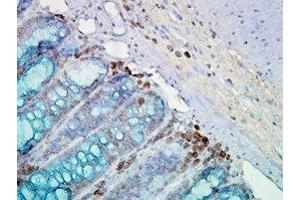 Hsp90 Immunohistochemistry.