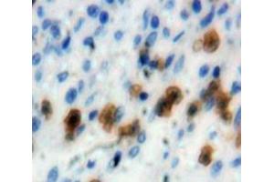 Used in DAB staining on fromalin fixed paraffin-embedded Spleen tissue (IRF4 Antikörper  (AA 175-433))