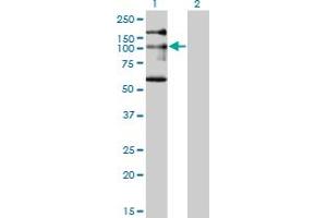 Western Blot analysis of NBR1 expression in transfected 293T cell line by NBR1 monoclonal antibody (M05), clone 5C3. (NBR1 Antikörper  (AA 2-96))