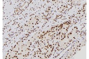 ABIN6276688 at 1/100 staining Human kidney tissue by IHC-P. (p21 Antikörper  (Internal Region))