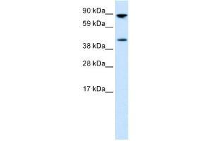 WB Suggested Anti-ETV4 Antibody Titration: 0.