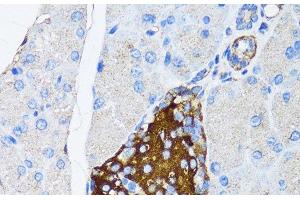 Immunohistochemistry of paraffin-embedded Mouse pancreatic islet using TIMP2 Polyclonal Antibody at dilution of 1:150 (40x lens). (TIMP2 Antikörper)
