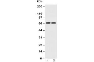 Western blot testing of GLUT12 antibody and Lane 1:  PC-12;  2: A549 cell lysate (GLUT12 Antikörper  (AA 256-272))