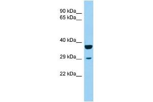 Host: Rabbit Target Name: KCTD1 Sample Type: 721_B Whole Cell lysates Antibody Dilution: 1. (KCTD1 Antikörper  (Middle Region))