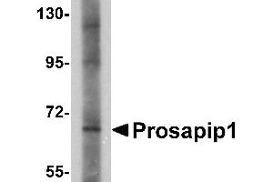 Western blot analysis of Prosapip1 in SK-N-SH cell lysate with Prosapip1 antibody at 1 µg/mL. (ProSAPiP1 Antikörper  (C-Term))