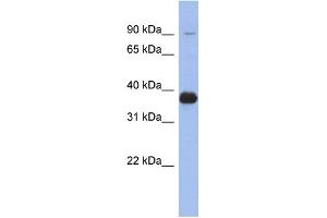 WB Suggested Anti-MPP3 Antibody Titration: 0. (MPP3 Antikörper  (Middle Region))