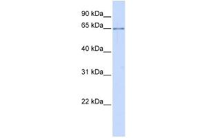 WB Suggested Anti-ALG6 Antibody Titration:  0. (ALG6 Antikörper  (N-Term))
